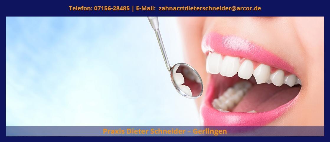 Zahnarzt für Bietigheim-Bissingen - Praxis Dieter Schneider: Prophylaxe, Wurzelbehandlung
